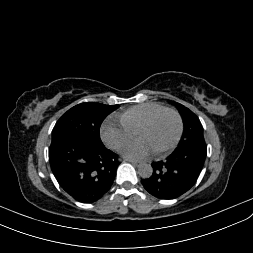 Axial CT slice